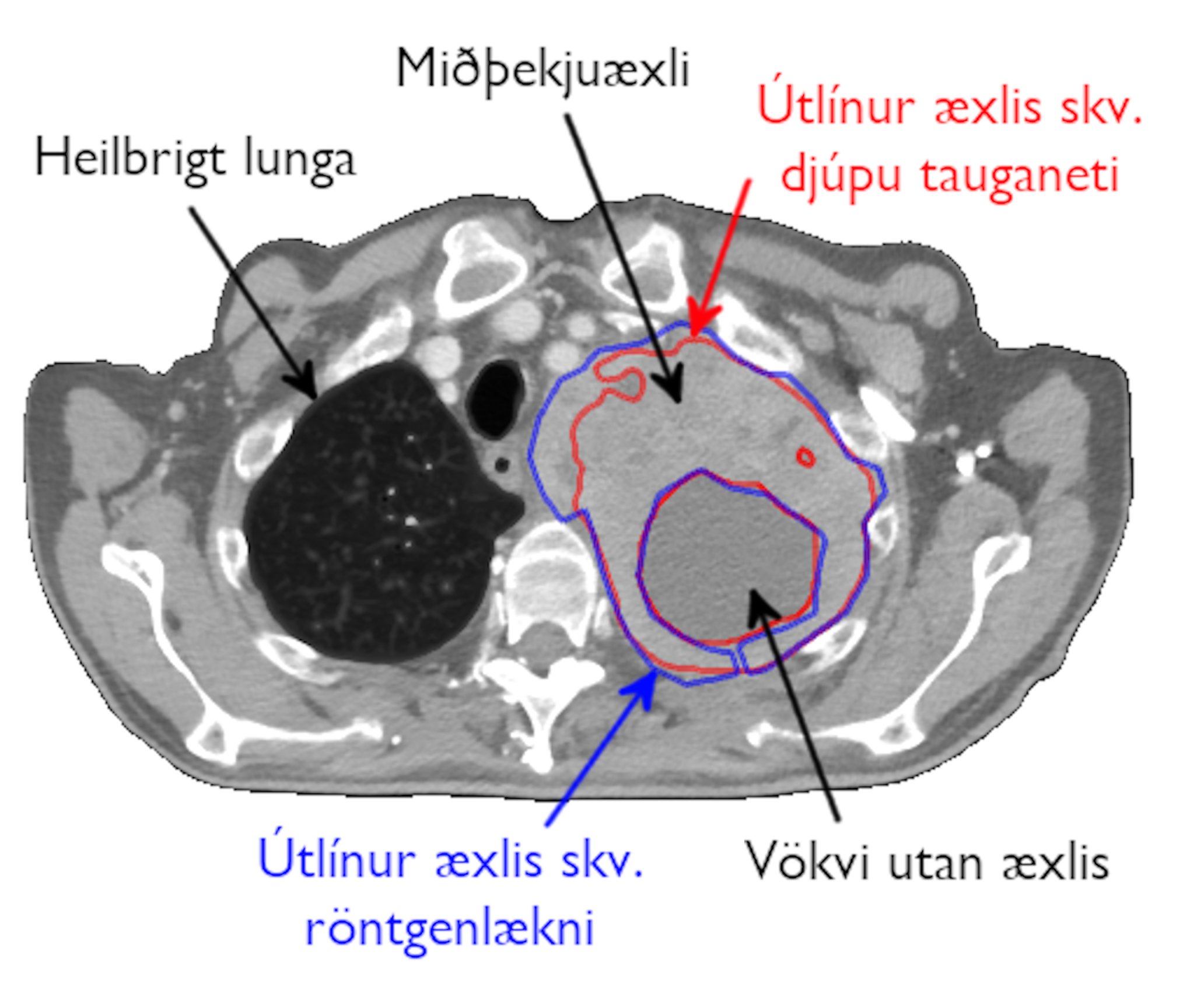 Mynd 1